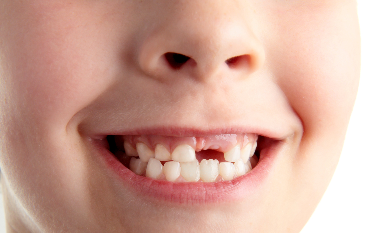 фото коренных зубов у ребенка