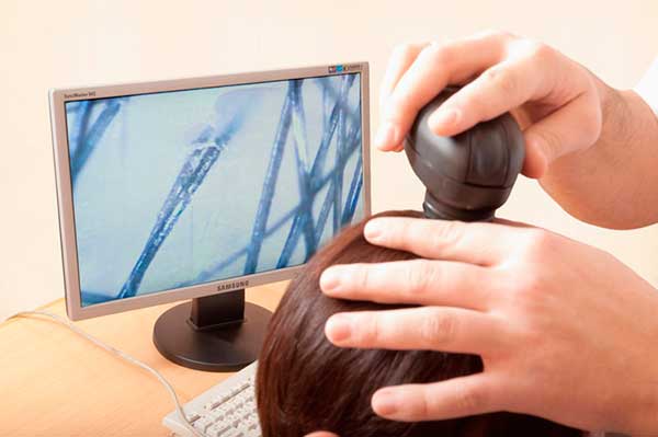 Выпадение волос при расчесывании у детей