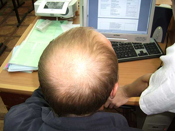 Выпадение волос при расчесывании у ребенка