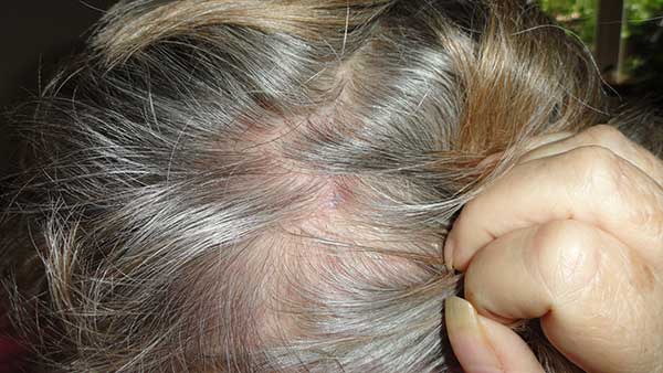 От выпадения волос настойка перца жгучего в домашних условиях