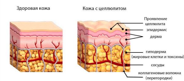 Аминофиллин в каких кремах содержится