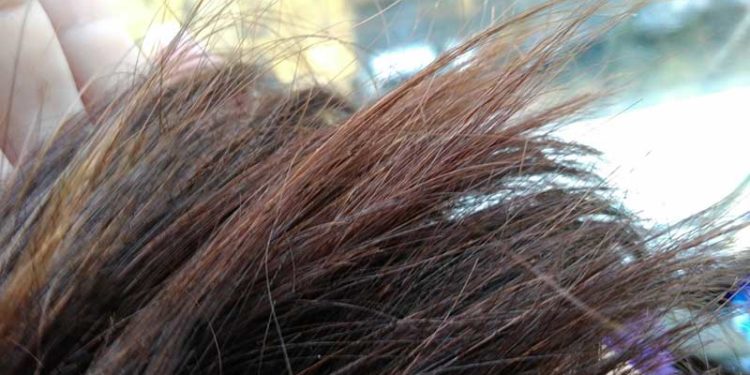 Лечение ломкости волос народные средства