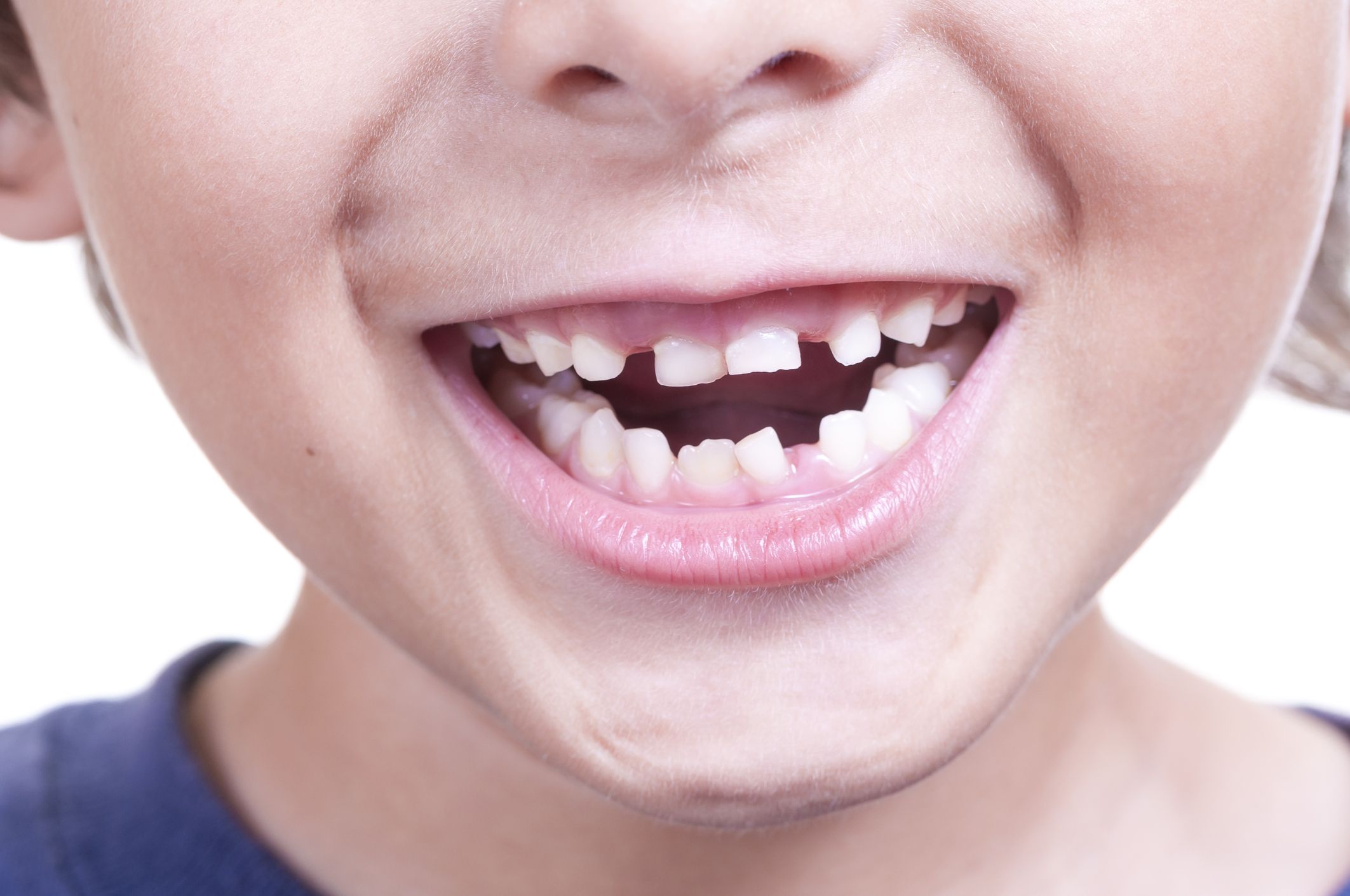 Почему растет второй. Ровные зубы у детей.